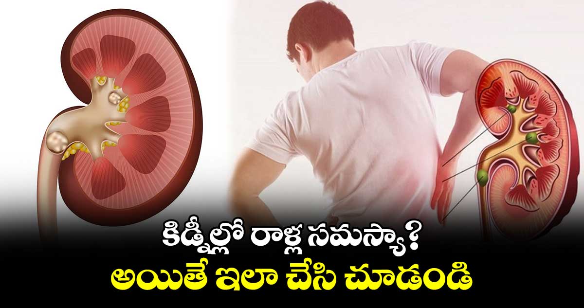 కిడ్నీల్లో రాళ్ల సమస్యా?.. అయితే ఇలా చేసి చూడండి..