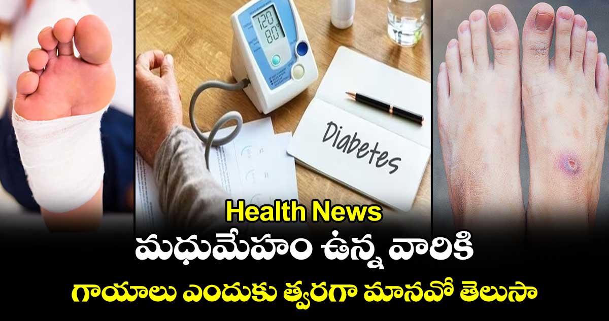 Health News: మధుమేహం ఉన్న వారికి గాయాలు ఎందుకు త్వరగా మానవో తెలుసా..