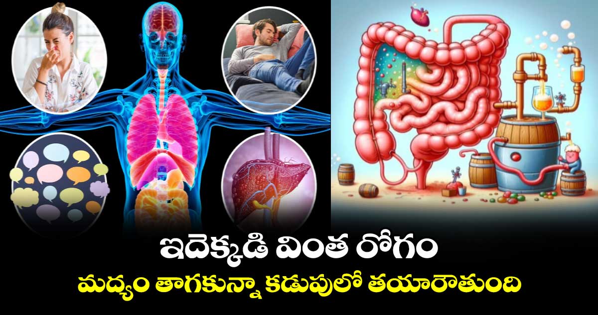 ఇదెక్కడి వింత రోగం.. మద్యం తాగకున్నా కడుపులో తయారవుతుంది