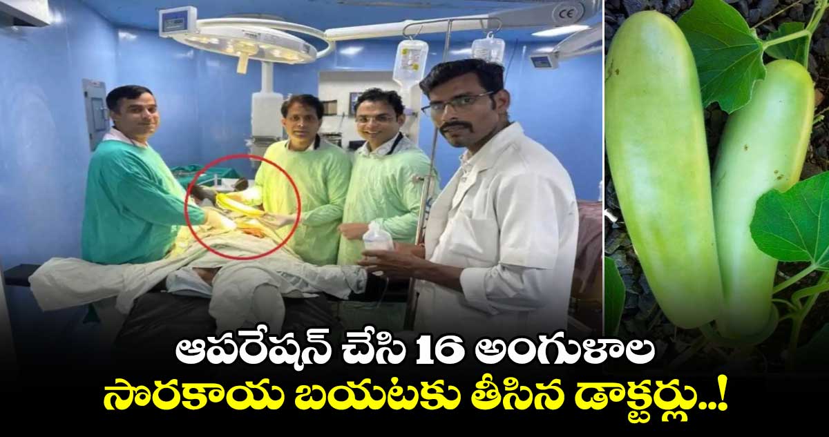 16-Inch Bottle Gourd:  ఆపరేషన్ చేసి 16 అంగుళాల సొరకాయ బయటకు తీసిన డాక్టర్లు..!