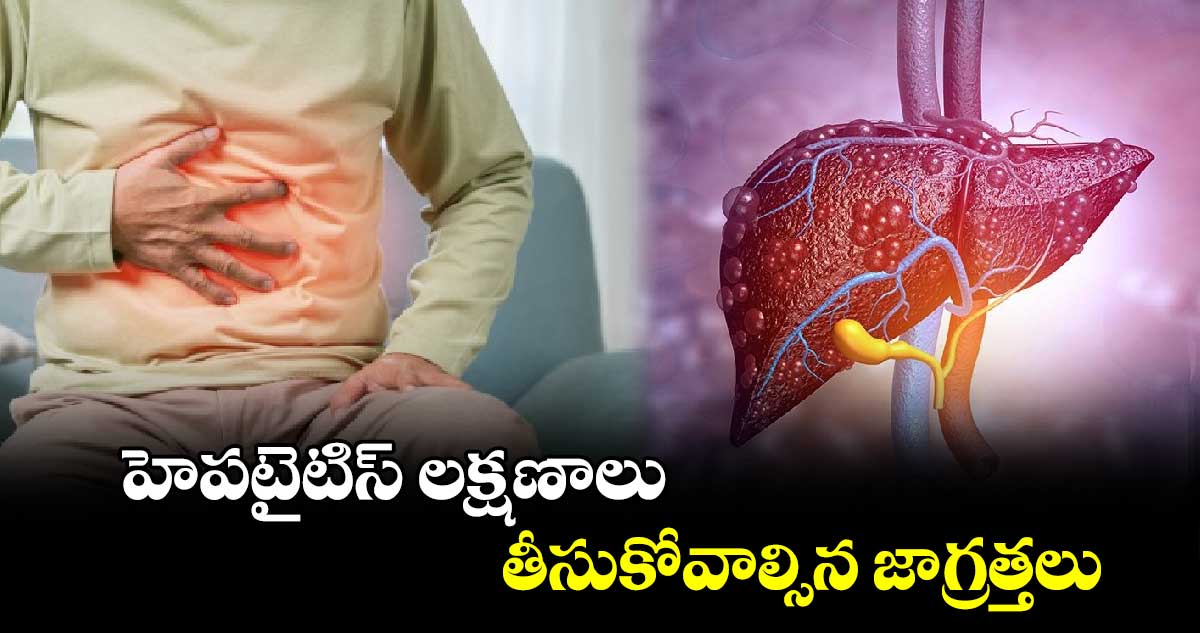 World Hepatitis Day 2024: హెపటైటిస్ లక్షణాలు.. తీసుకోవాల్సిన జాగ్రత్తలు.. 