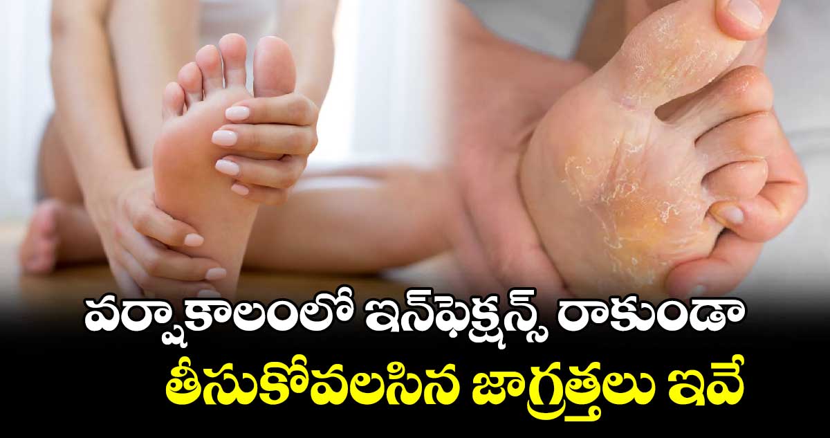 Health Tips: వర్షాకాలంలో  ఇన్​ఫెక్షన్స్ రాకుండా తీసుకోవలసిన జాగ్రత్తలు ఇవే.