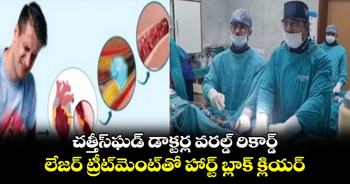 చత్తీస్‌ఘడ్ డాక్టర్ల వరల్డ్ రికార్డ్.. లేజర్‌ ట్రీట్‌మెంట్‌తో హార్ట్ బ్లాక్ క్లియర్