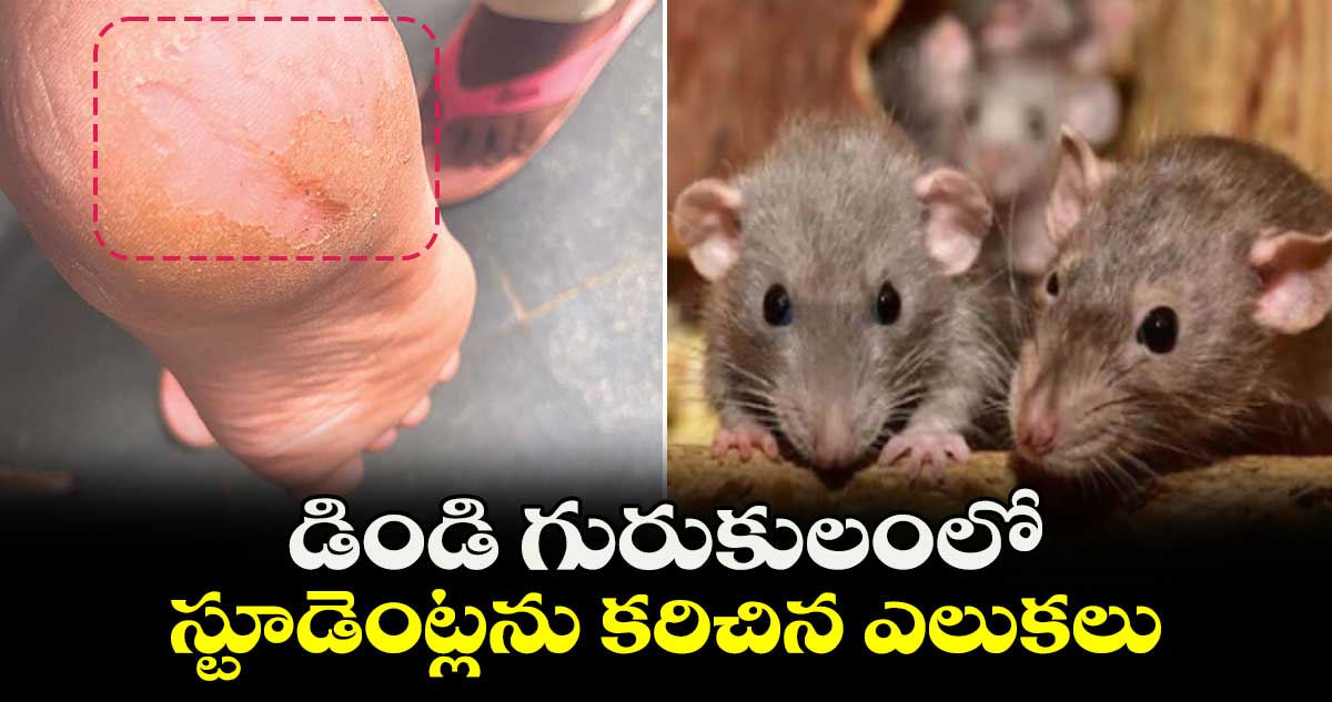 డిండి గురుకులంలో స్టూడెంట్లను కరిచిన ఎలుకలు