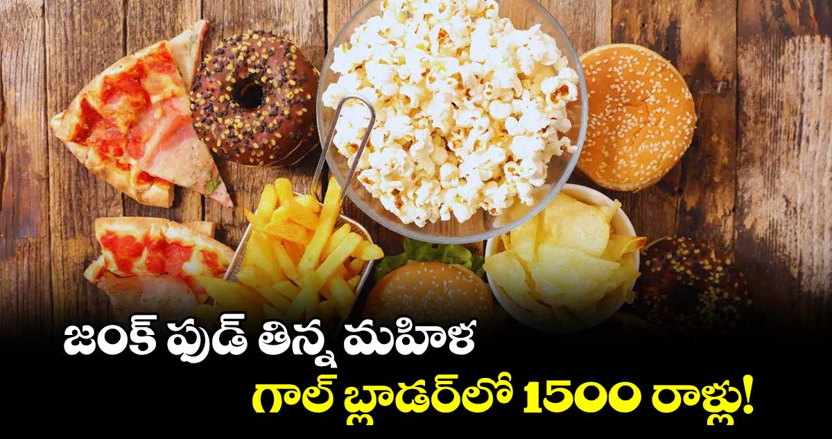 జంక్ ఫుడ్ తిన్న మహిళ..గాల్ బ్లాడర్‌‌లో 1500 రాళ్లు!