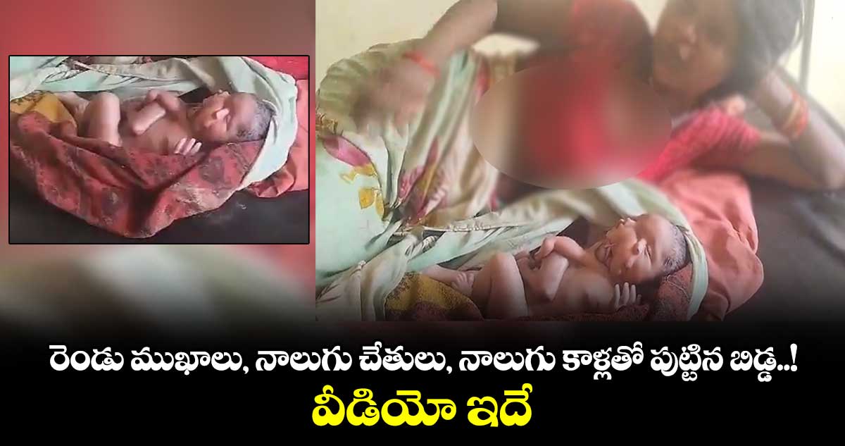 Viral Video: రెండు ముఖాలు, నాలుగు చేతులు, నాలుగు కాళ్లతో పుట్టిన బిడ్డ..! వీడియో ఇదే..