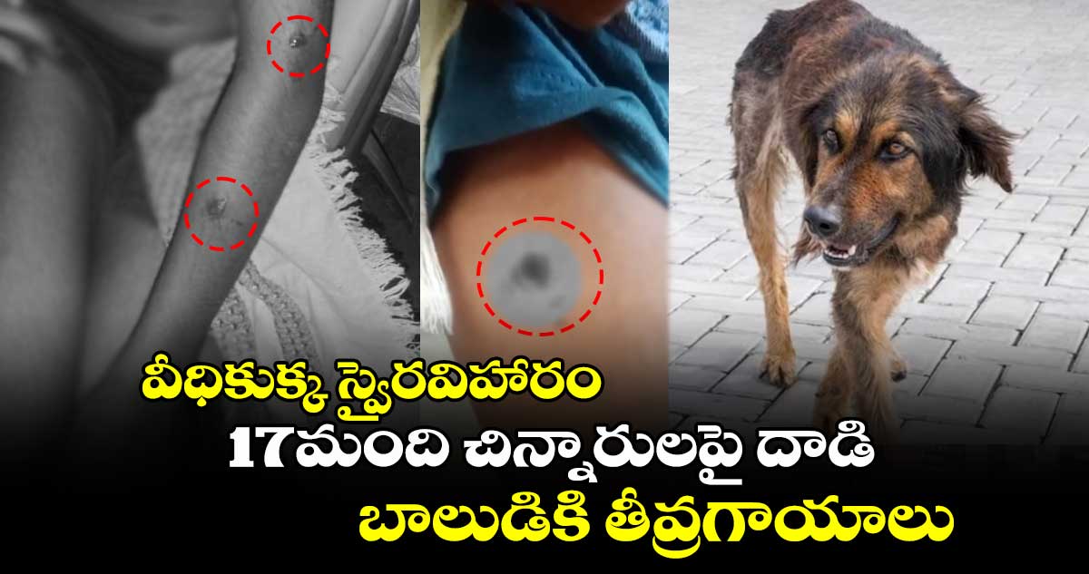 వీధికుక్క స్వైరవిహారం..17మంది చిన్నారులపై దాడి.. బాలుడికి తీవ్రగాయాలు