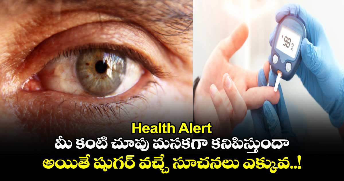 Health Alert : మీ కంటి చూపు మసకగా కనిపిస్తుందా.. అయితే షుగర్ వచ్చే సూచనలు ఎక్కువ..!