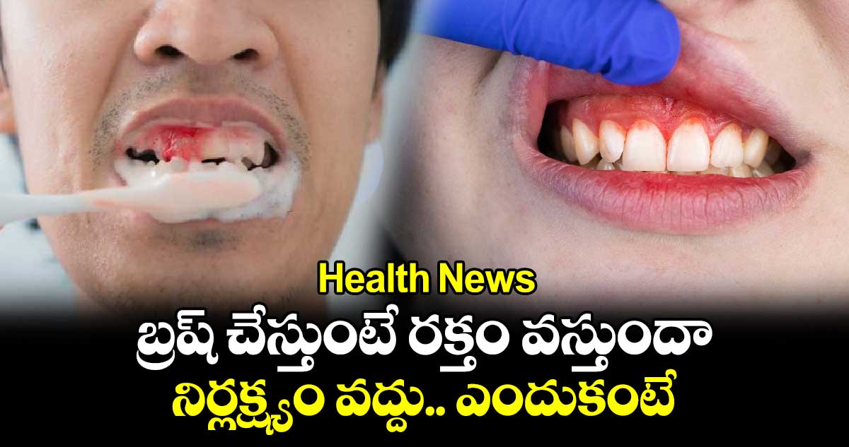 Health News: బ్రష్​ చేస్తుంటే రక్తం వస్తుందా.. నిర్లక్ష్యం వద్దు.. ఎందుకంటే