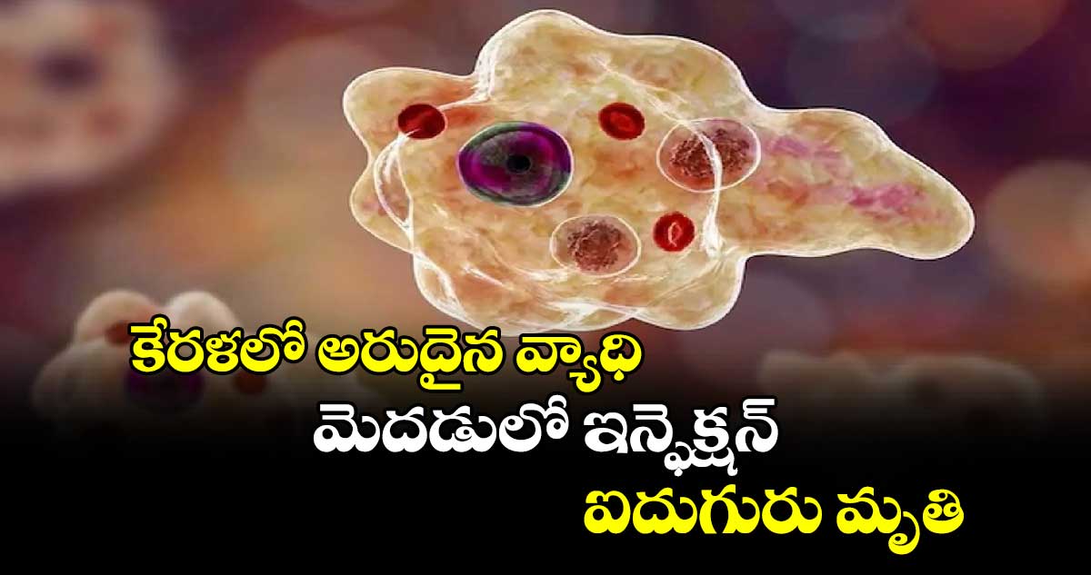 కేరళలో అరుదైన వ్యాధి..మెదడులో ఇన్ఫెక్షన్..ఐదుగురు మృతి