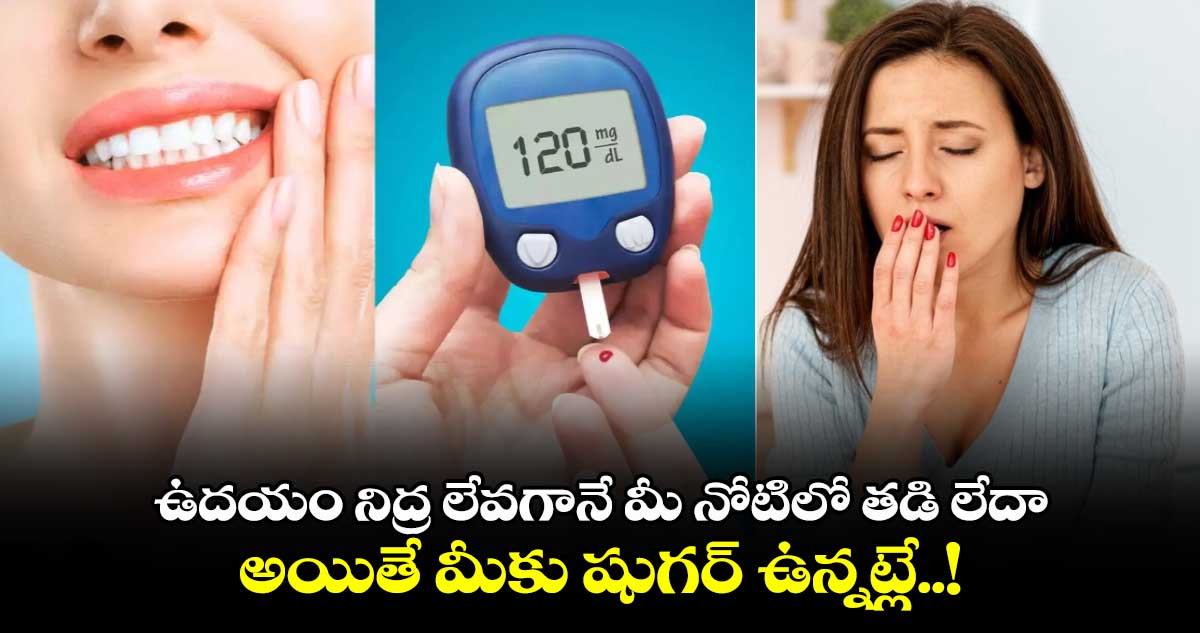 Health News : ఉదయం నిద్ర లేవగానే మీ నోటిలో తడి లేదా.. అయితే మీకు షుగర్ ఉన్నట్లే..!