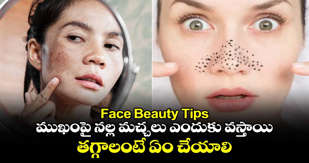 Face Beauty Tips:ముఖంపై నల్ల మచ్చలు ఎందుకు వస్తాయి.. తగ్గాలంటే ఏం చేయాలి