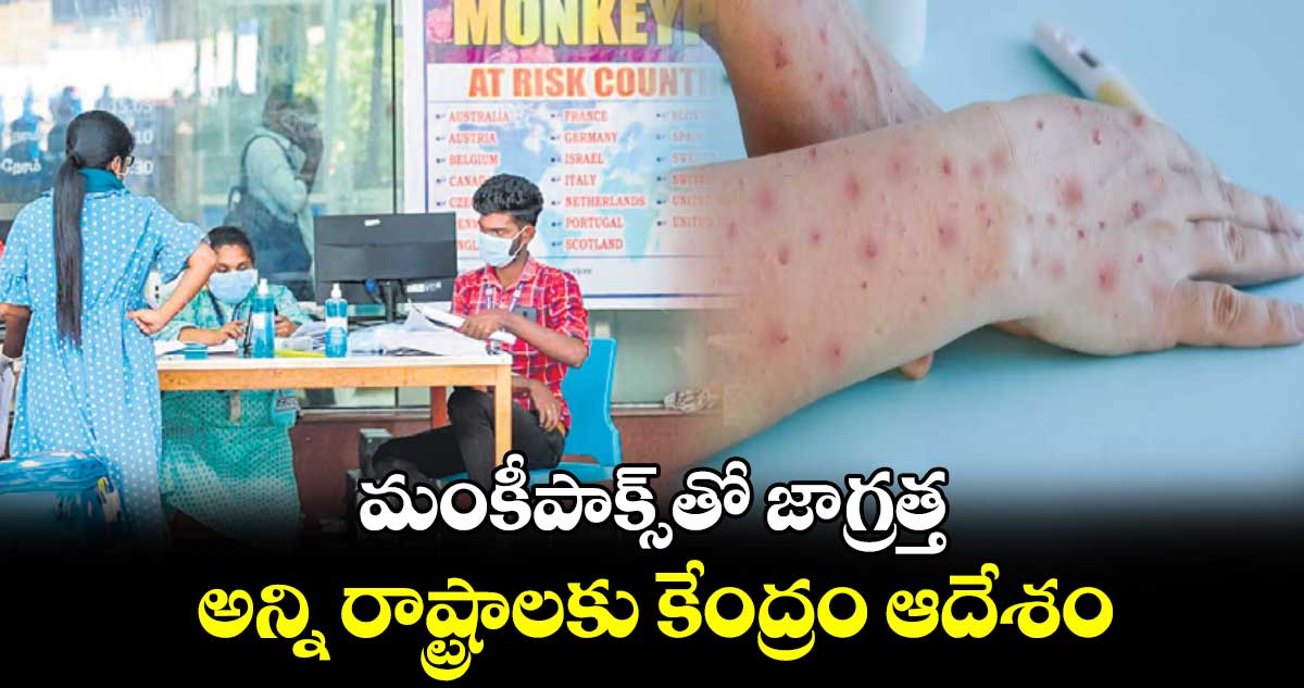 మంకీపాక్స్తో జాగ్రత్త.. అన్ని రాష్ట్రాలకు కేంద్రం ఆదేశం