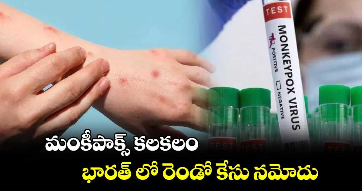 మంకీపాక్స్ కలకలం: భారత్ లో రెండో కేసు నమోదు...