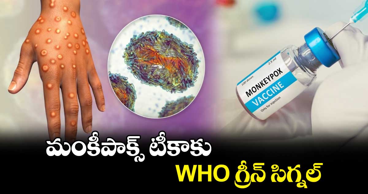 మంకీపాక్స్ టీకాకు WHO గ్రీన్ సిగ్నల్