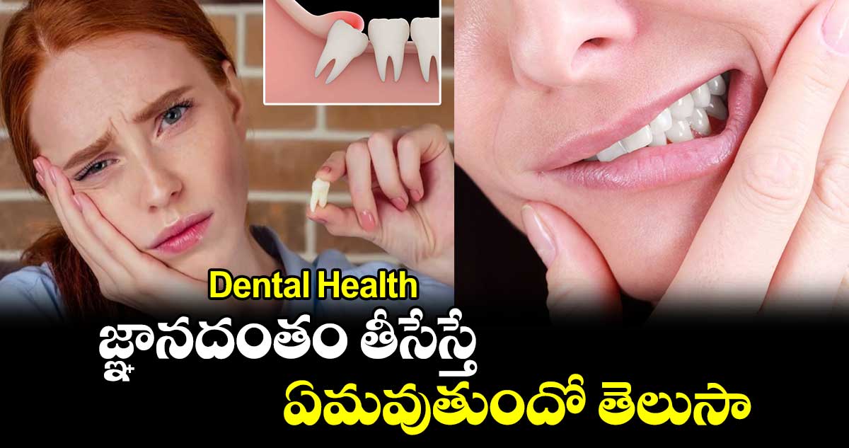 Dental Health: జ్ఞానదంతం తీసేస్తే ఏమవుతుందో తెలుసా..