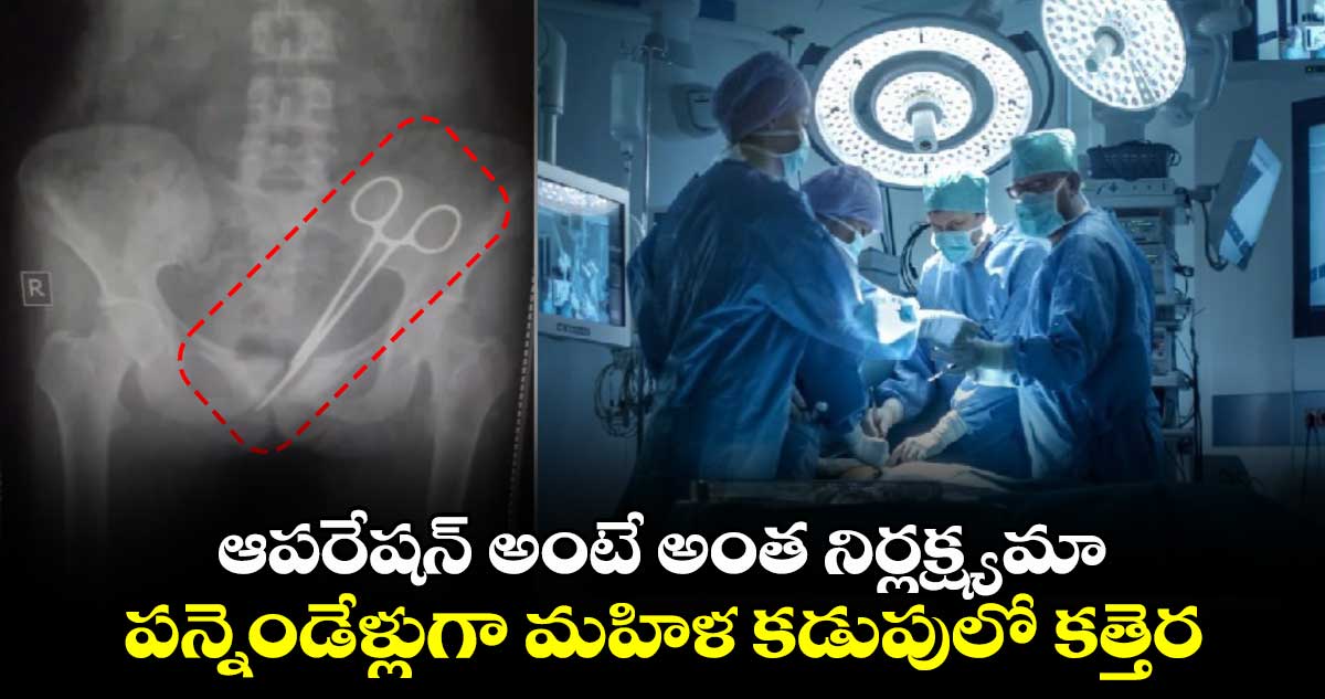 ఆపరేషన్ అంటే అంత నిర్లక్ష్యమా.. పన్నెండేళ్లుగా మహిళ కడుపులో కత్తెర