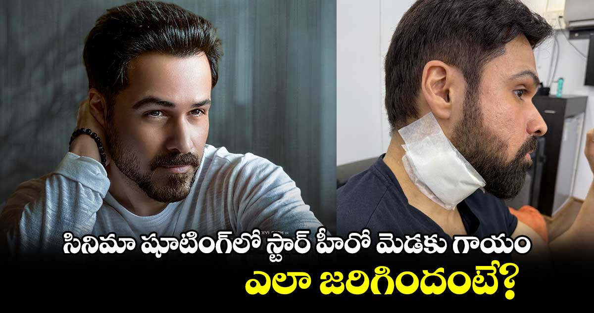 సినిమా షూటింగ్⁭లో స్టార్ హీరో మెడకు గాయం.. ఎలా జరిగిందంటే? 