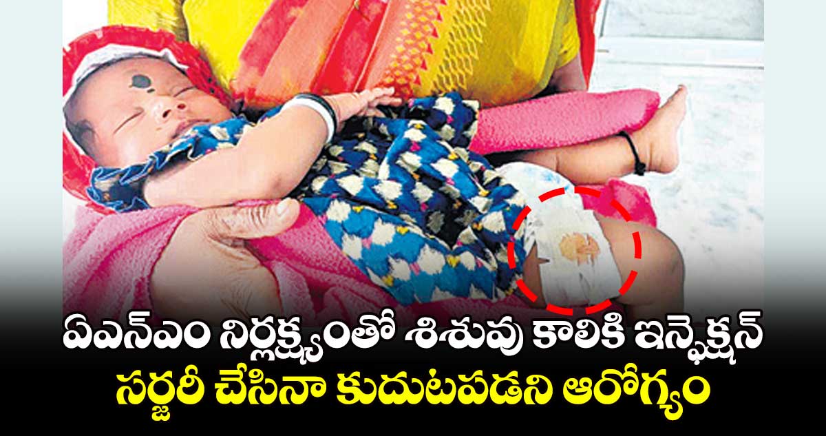 ఏఎన్ఎం నిర్లక్ష్యంతో శిశువు కాలికి ఇన్ఫెక్షన్ .. సర్జరీ చేసినా కుదుటపడని ఆరోగ్యం