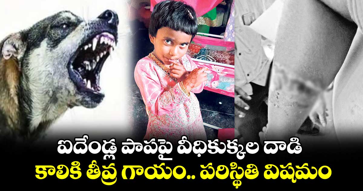 ఐదేండ్ల పాపపై వీధికుక్కల దాడి కాలికి తీవ్ర గాయం.. పరిస్థితి విషమం