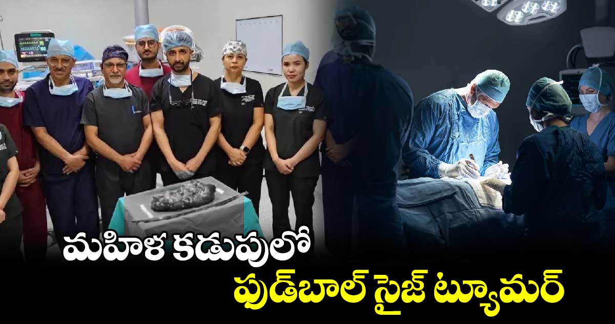 మహిళ కడుపులో ఫుడ్‌బాల్ సైజ్ ట్యూమర్