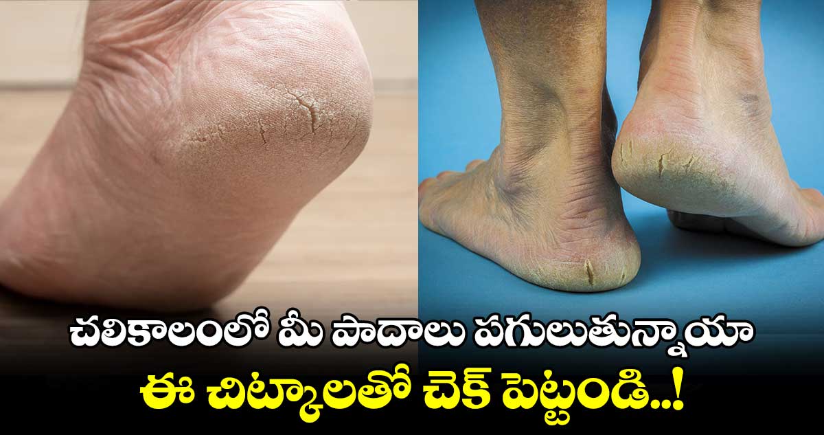 Women Beauty : చలికాలంలో మీ పాదాలు పగులుతున్నాయా.. ఈ చిట్కాలతో చెక్ పెట్టండి..!