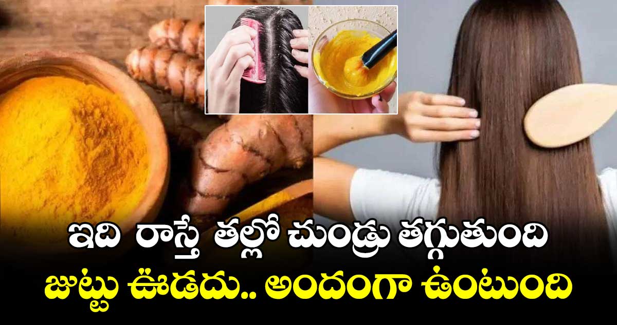 Hair beauty: ఇది  రాస్తే  తల్లో చుండ్రు తగ్గుతుంది...జుట్టు ఊడదు.. అందంగా ఉంటుంది..