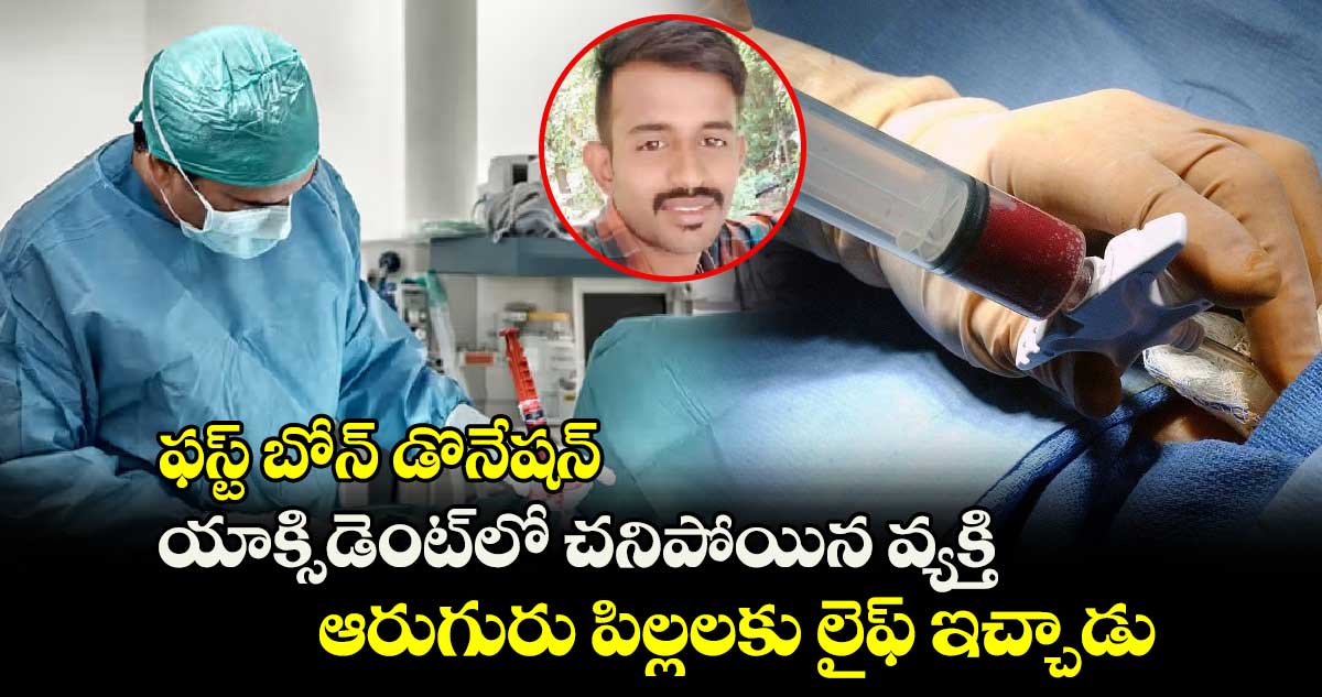 ఫస్ట్ బోన్ డొనేషన్..యాక్సిడెంట్⁬లో చనిపోయిన వ్యక్తి..ఆరుగురు పిల్లలకు లైఫ్ ఇచ్చాడు