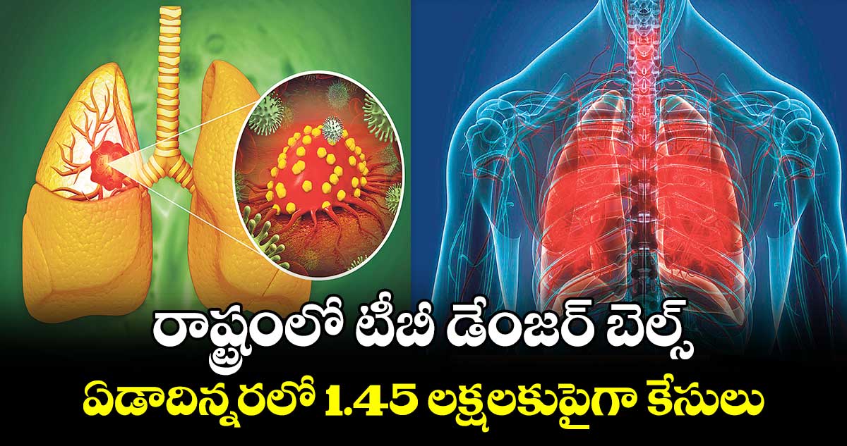 రాష్ట్రంలో టీబీ డేంజర్​ బెల్స్: ఏడాదిన్నరలో 1.45 లక్షలకుపైగా కేసులు