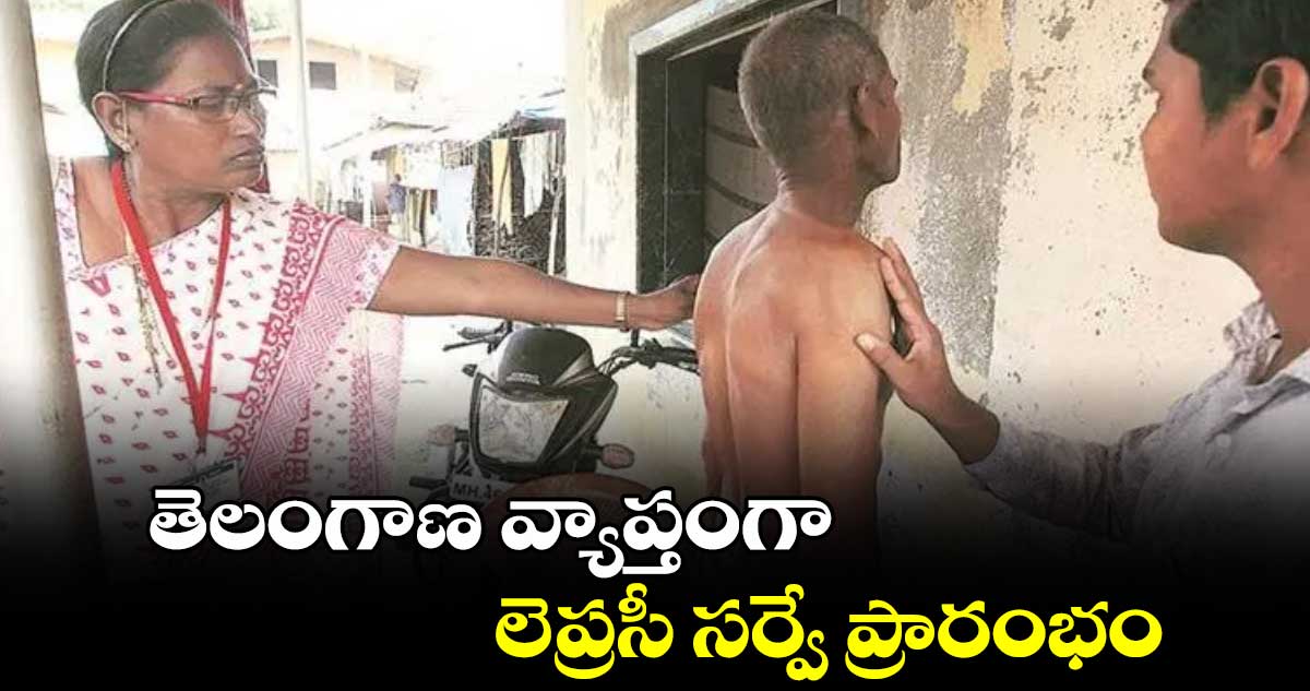 తెలంగాణ వ్యాప్తంగా లెప్రసీ సర్వే ప్రారంభం