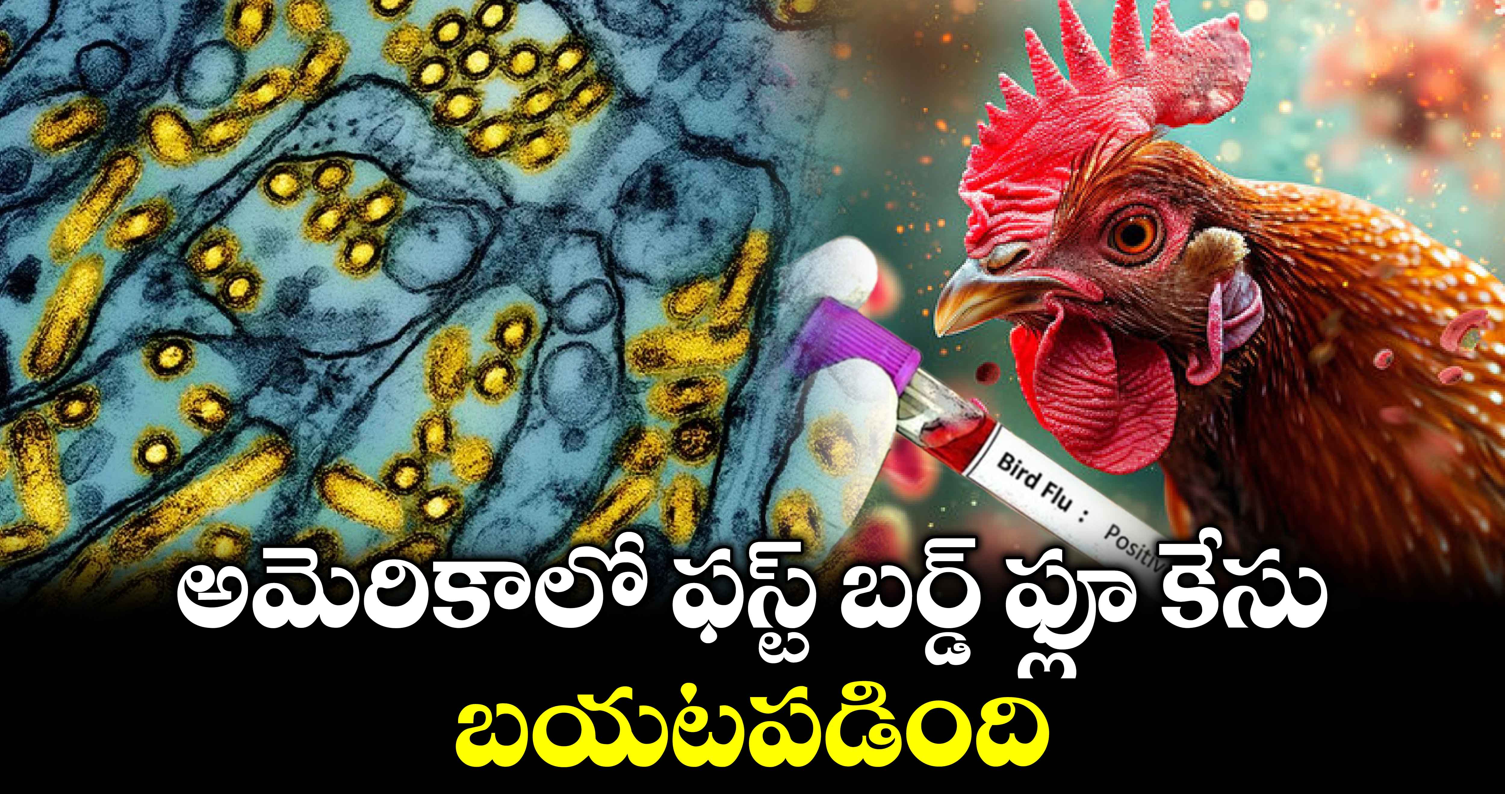 bird flu(H5N1)Case: అమెరికాలో ఫస్ట్ బర్డ్ ఫ్లూ కేసు బయటపడింది..