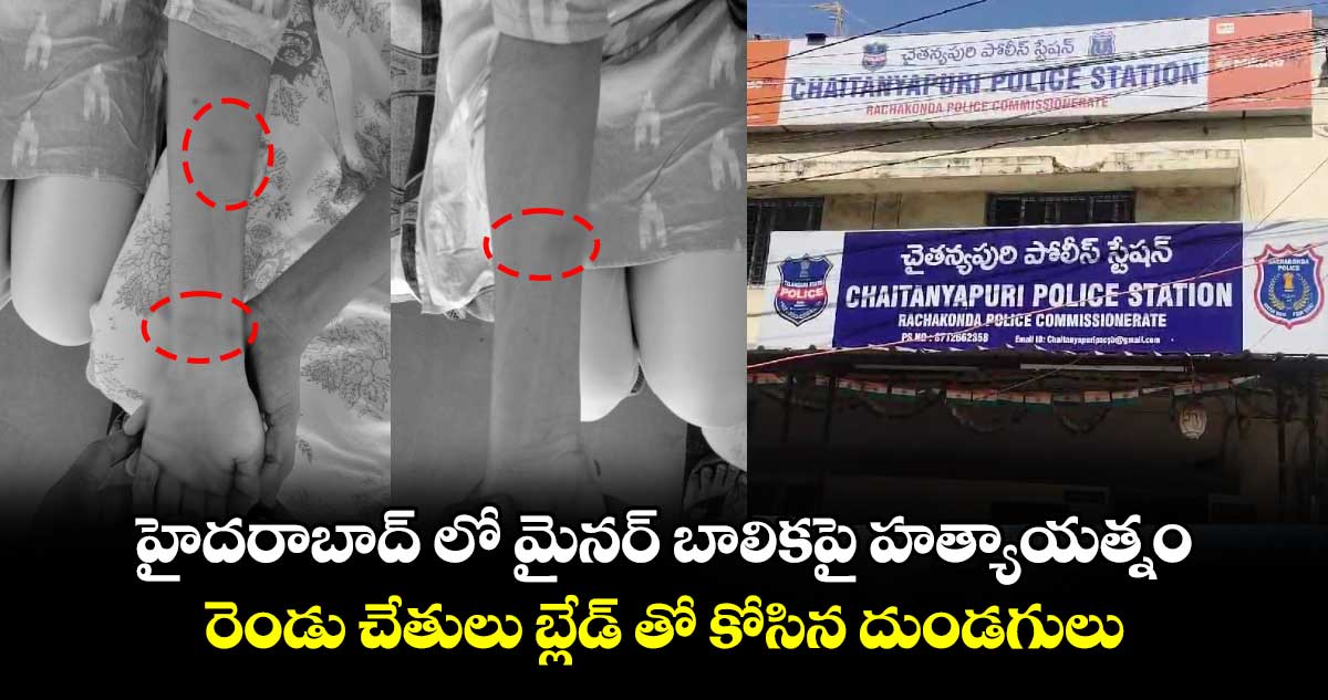 హైదరాబాద్ లో మైనర్ బాలికపై హత్యాయత్నం.. రెండు చేతులు బ్లేడ్ తో కోసిన దుండగులు.. 