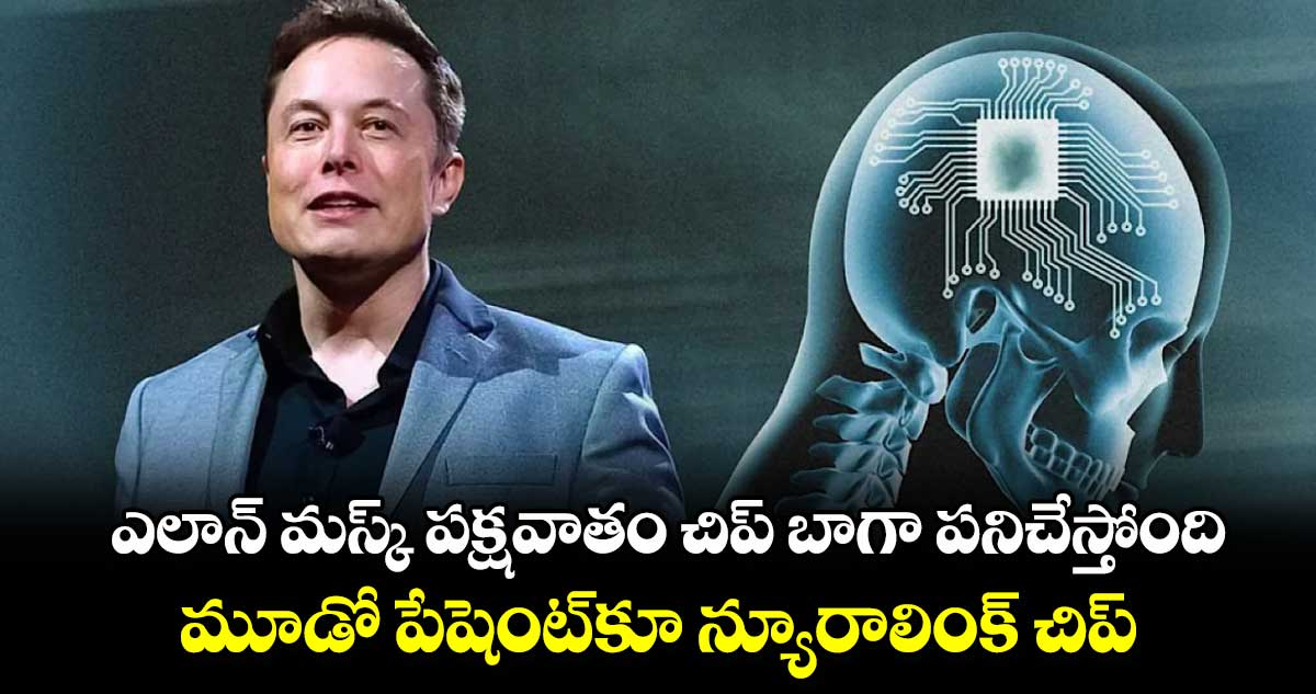 ఎలాన్ మస్క్ పక్షవాతం చిప్ బాగా పనిచేస్తోంది..మూడో పేషెంట్​కూ న్యూరాలింక్ చిప్