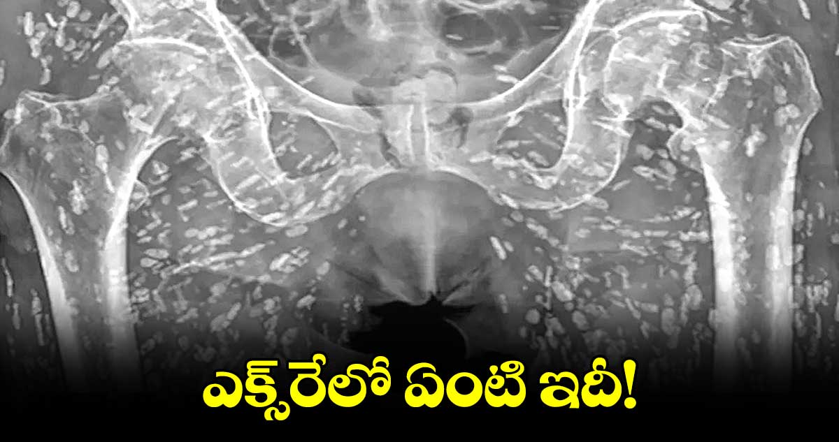 ఎక్స్​రేలో ఏంటి ఇదీ!