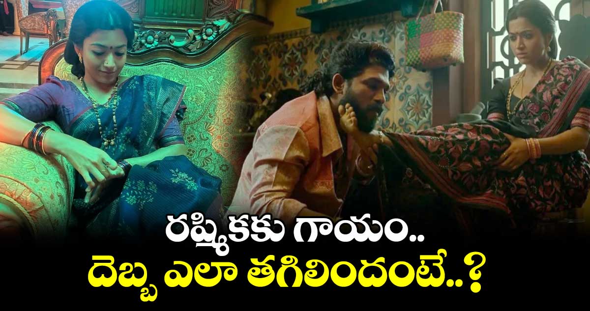 Rashmika Mandanna: రష్మికకు గాయం.. దెబ్బ ఎలా తగిలిందంటే..?