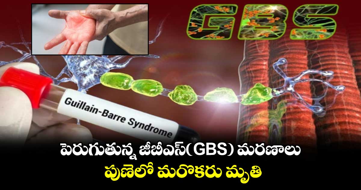 Health Alert: పెరుగుతున్న జీబీఎస్(GBS)⁬ మరణాలు..పుణెలో మరొకరు మృతి