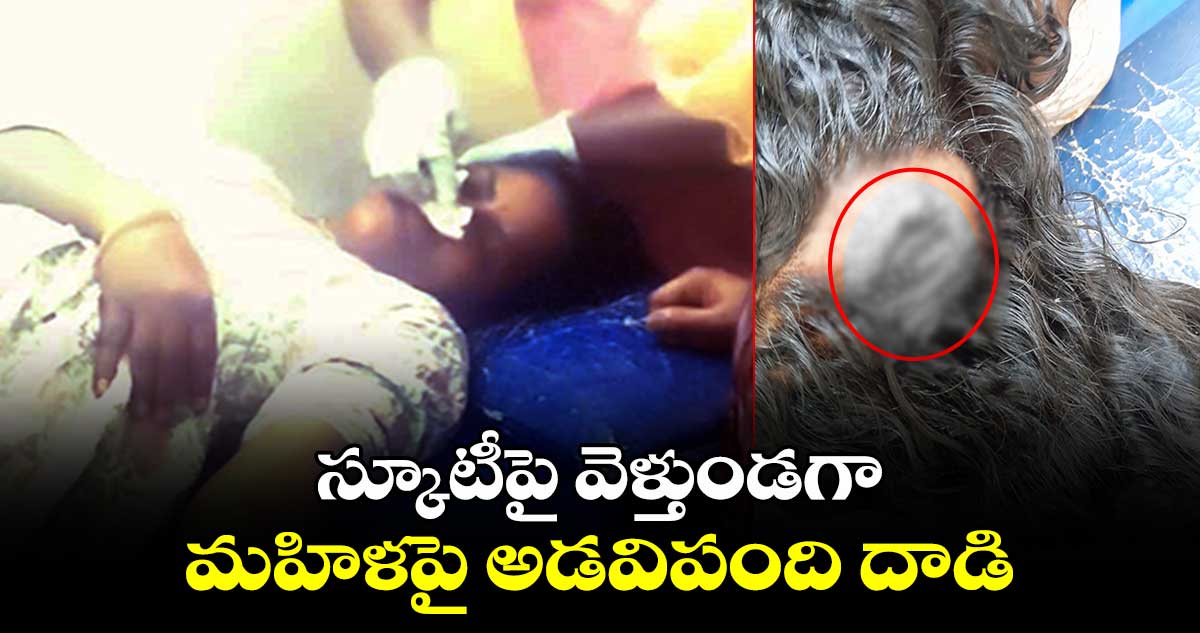 స్కూటీపై వెళ్తుండగా..మహిళపై అడవిపంది దాడి 