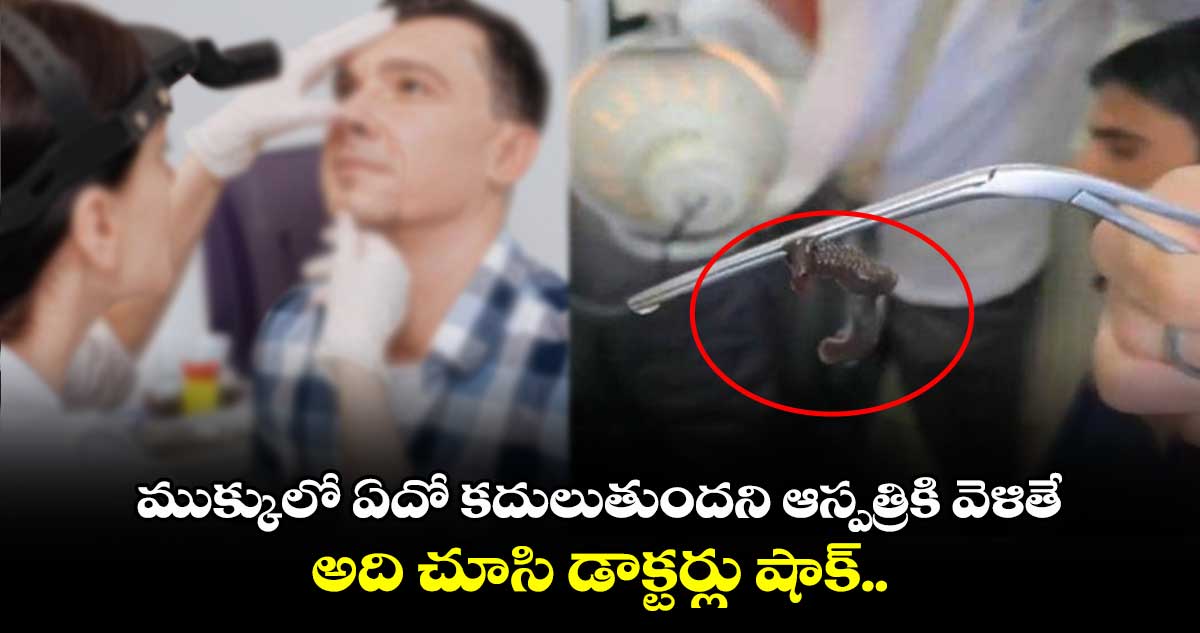 viral news:ముక్కులో ఏదో కదులుతుందని ఆస్పత్రికి వెళితే..అది చూసి డాక్టర్లు షాక్.. 