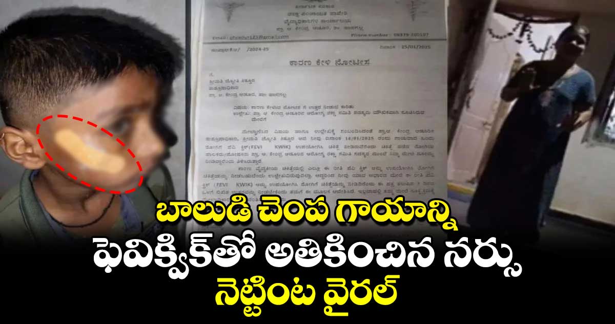 Viral news: బాలుడి చెంప గాయాన్ని ఫెవిక్విక్⁬తో అతికించిన నర్సు..నెట్టింట వైరల్ 