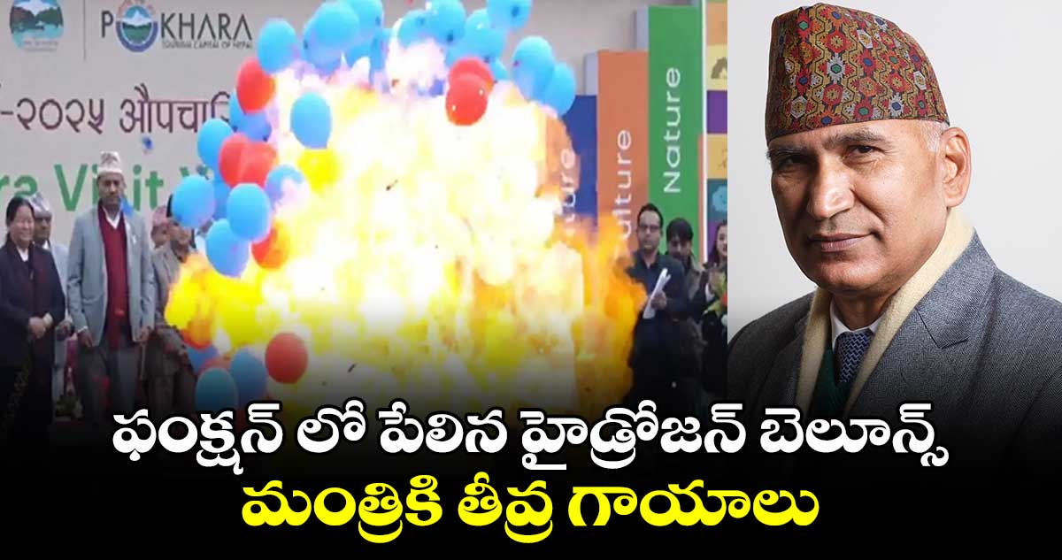 ఫంక్షన్ లో పేలిన హైడ్రోజన్ బెలూన్స్..  మంత్రికి  తీవ్ర గాయాలు