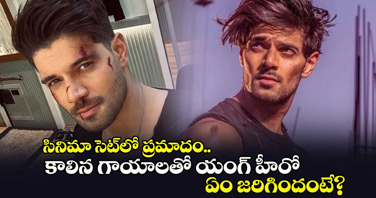 Sooraj Pancholi: సినిమా సెట్⁭లో ప్రమాదం.. కాలిన గాయాలతో యంగ్ హీరో.. ఏం జరిగిందంటే?