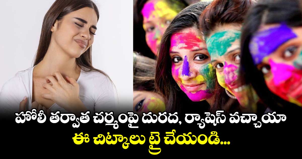 హోలీ తర్వాత చర్మంపై దురద, ర్యాషెస్ వచ్చాయా.. ఈ చిట్కాలు ట్రై చేయండి...