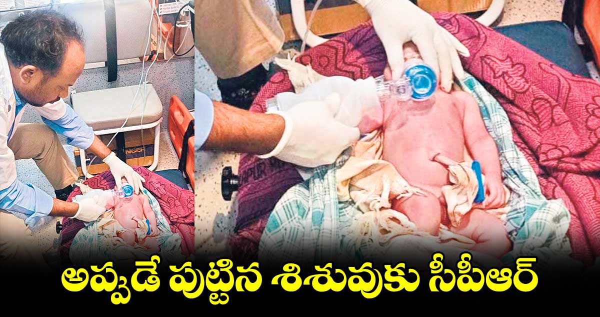 అప్పుడే పుట్టిన శిశువుకు సీపీఆర్