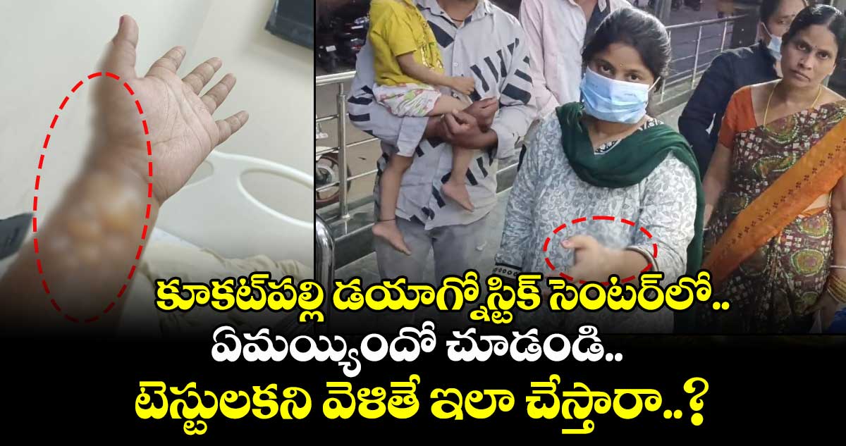 కూకట్⁭పల్లి డయాగ్నోస్టిక్ సెంటర్⁭లో ఏమయ్యిందో చూడండి.. టెస్టులకని వెళితే ఇలా చేస్తారా..?