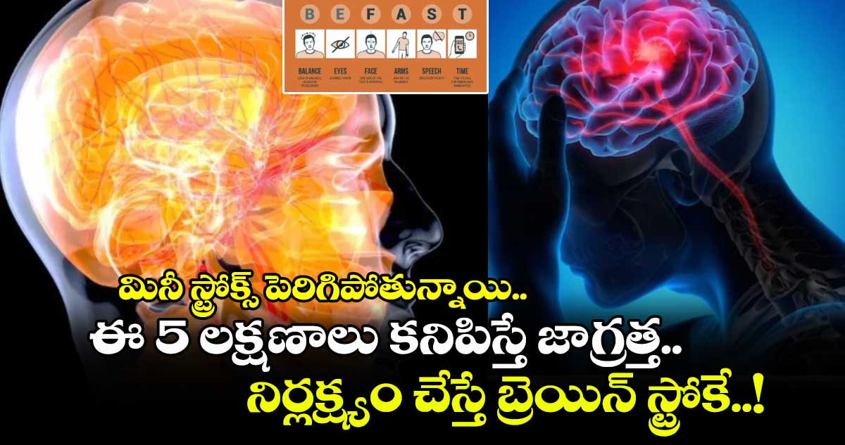 Health Alert : మినీ స్ట్రోక్స్ పెరిగిపోతున్నాయి.. ఈ 5 లక్షణాలు కనిపిస్తే జాగ్రత్త.. నిర్లక్ష్యం చేస్తే బ్రెయిన్ స్ట్రోకే..!