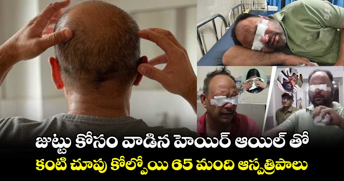 జుట్టు కోసం వాడిన హెయిర్ ఆయిల్ తో.. కంటి చూపు కోల్పోయి 65 మంది ఆస్పత్రిపాలు