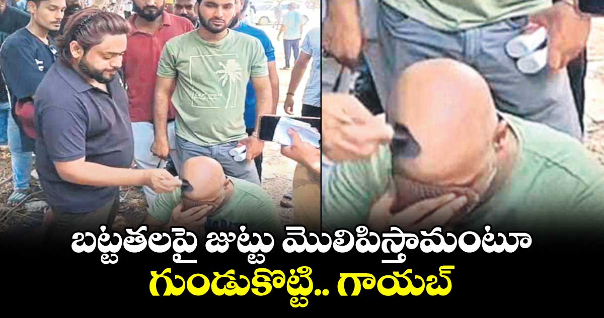 బట్టతలపై జుట్టు మొలిపిస్తామంటూ గుండుకొట్టి.. గాయబ్