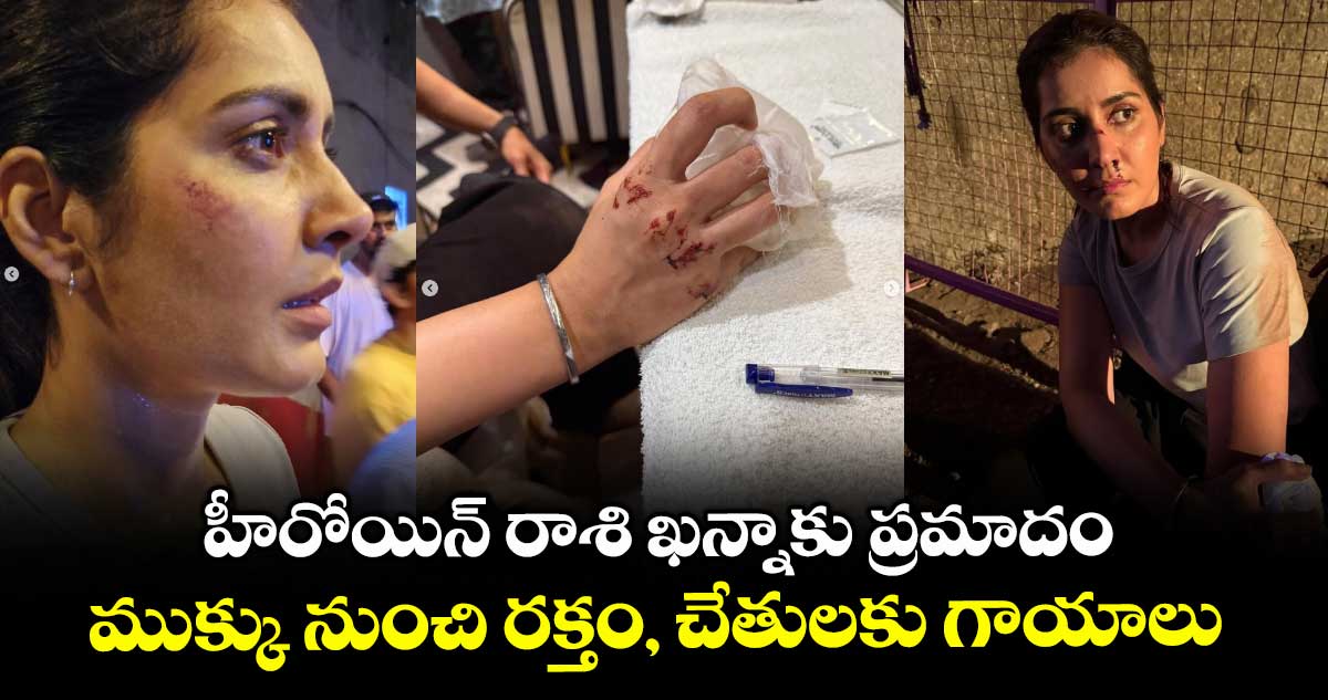 Rashi Khanna: హీరోయిన్ రాశి ఖన్నాకు ప్రమాదం.. ముక్కు నుంచి రక్తం, చేతులకు గాయాలు.. ఫోటోలు వైరల్