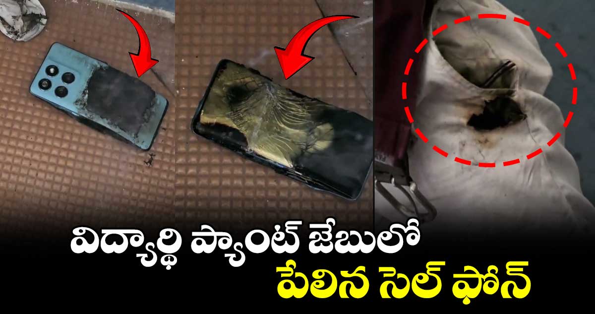 విద్యార్థి ప్యాంట్ జేబులో పేలిన సెల్ ఫోన్
