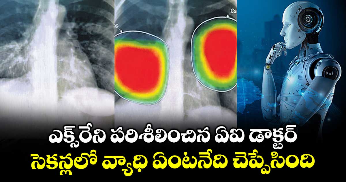 ఎక్స్రేని పరిశీలించిన ఏఐ డాక్టర్..సెకన్లలో వ్యాధి ఏంటనేది చెప్పేసింది